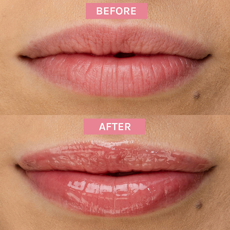 Bio-Retinol Glossy Lip Oil, Έλαιο Χειλιών με Ρετινόλη, 15ml, EVOLVE